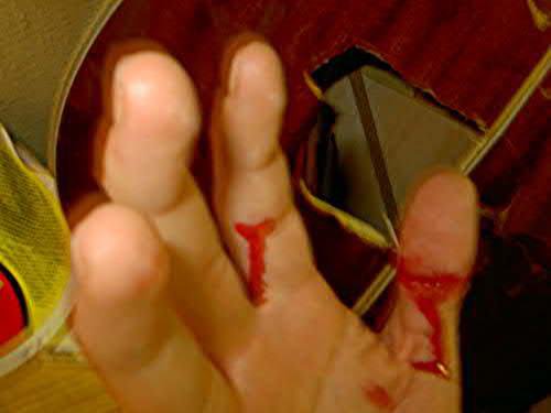 That’s What You Get For Punching a Guitar !